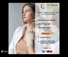 Best wart removal dermatologist in Hyderabad